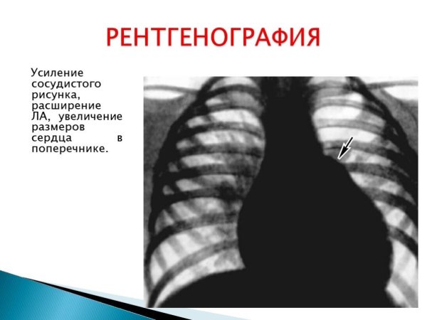 Усил ение логочного рисунка