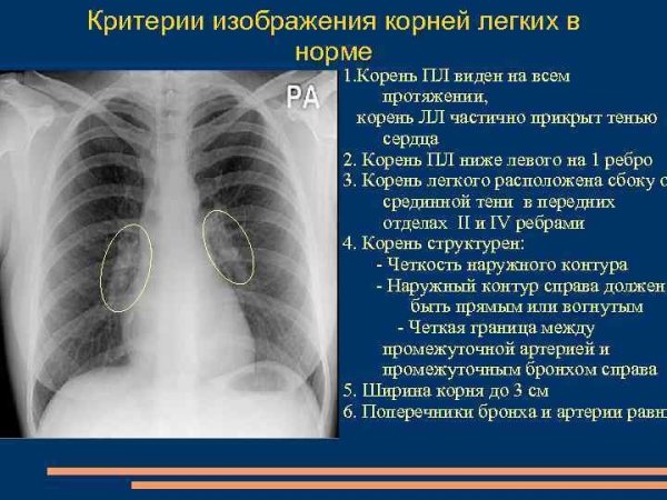 Училение лёгочного рисунка