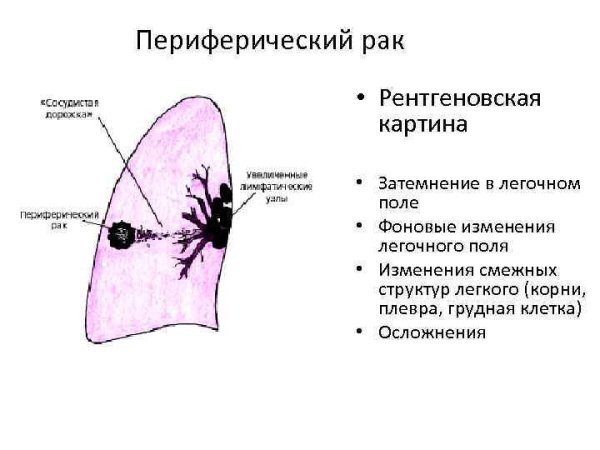 Осевая и Центральная симметрия рисунки