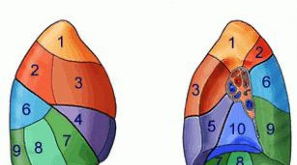 Легкое строение анатомия сегменты