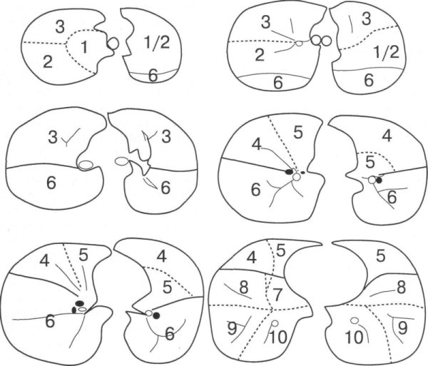 Строение легких доли сегменты дольки