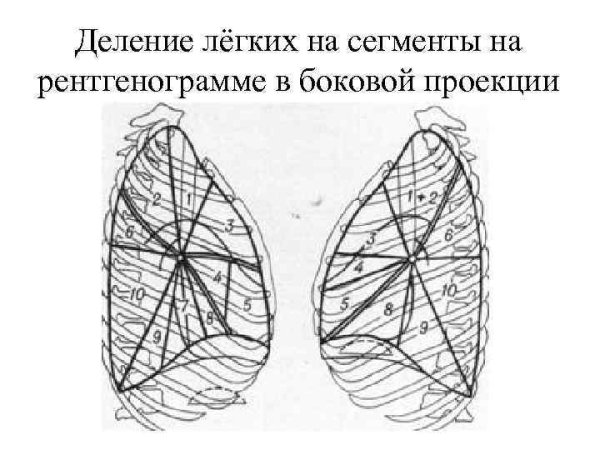 Сегменты легких на рентгенограмме схема
