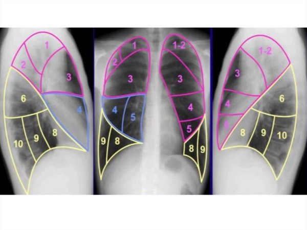 Доли и сегменты легких