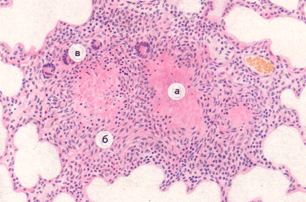 Клетки Пирогова Лангханса