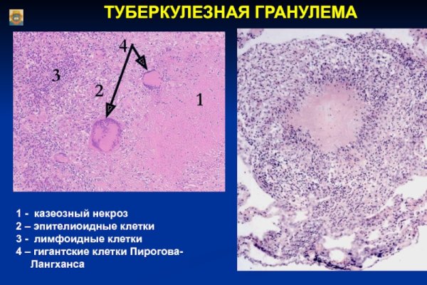 Клетки Пирогова Лангханса гистология