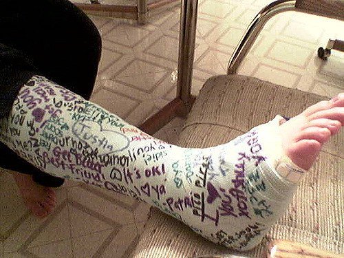 Рисунки на гипсе на ноге