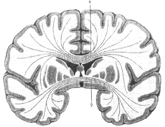 Горизонтальный разрез головного мозга базальные ядра