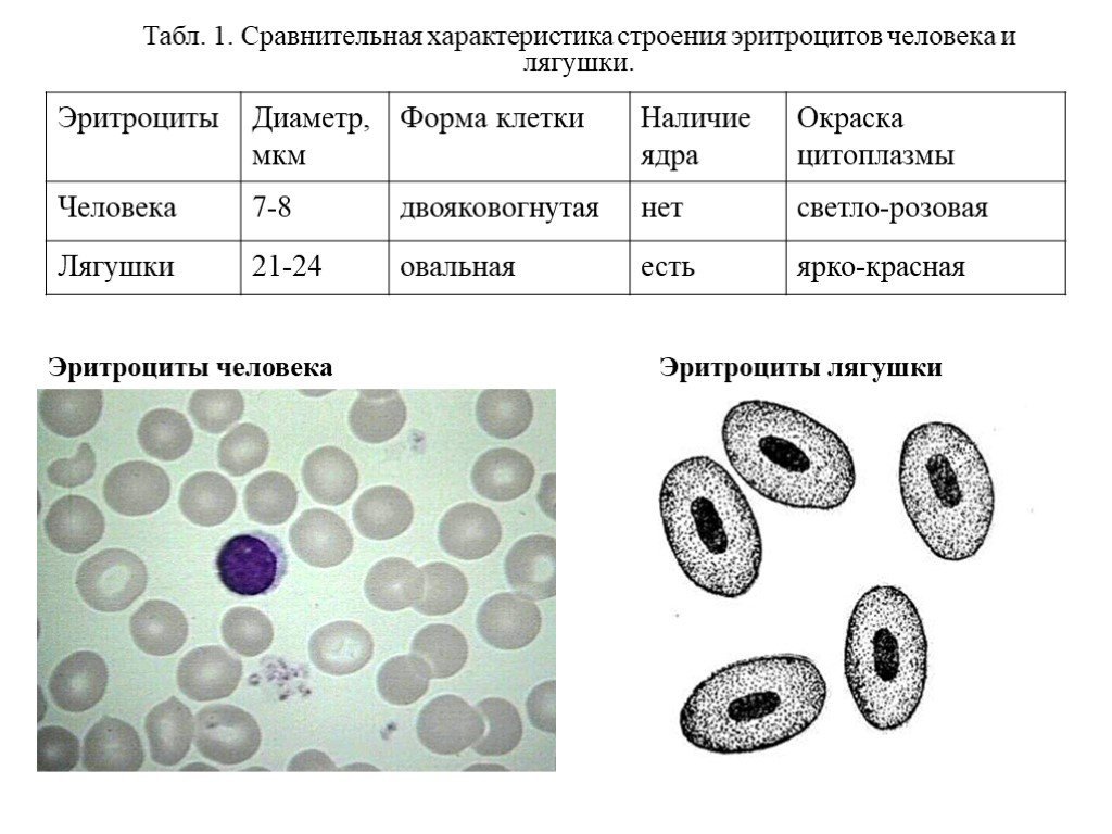 Наличие ядра человека. Форма клетки эритроцитов лягушки. Форма клетки эритроцитов человека и лягушки. Строение эритроцита крови лягушки. Форма клетки крови человека и лягушки таблица.
