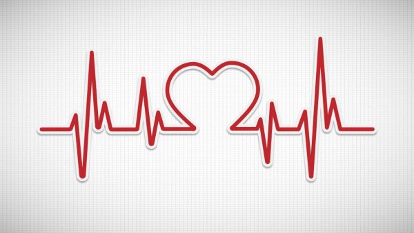 Нарисовать пульс