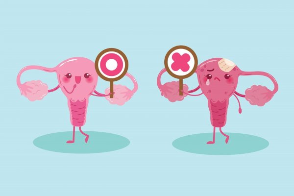 Стикеры матка