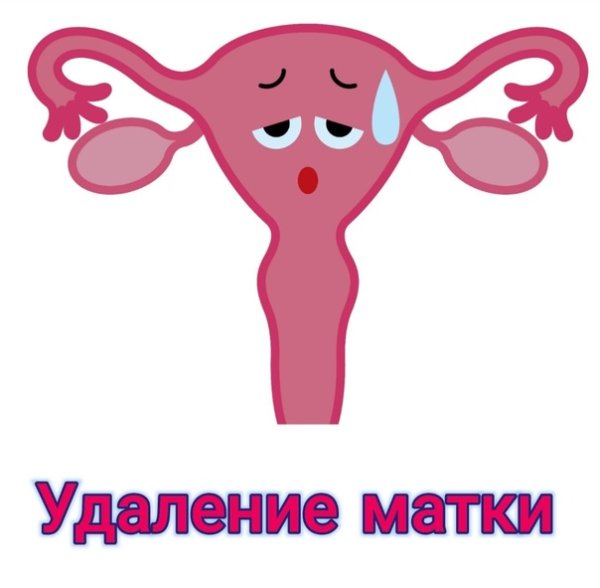 Красивая матка