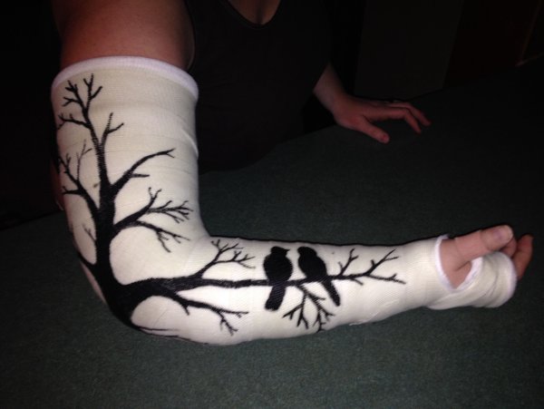 Разрисованный гипс на ноге