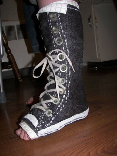 Разукрашенный гипс на ноге