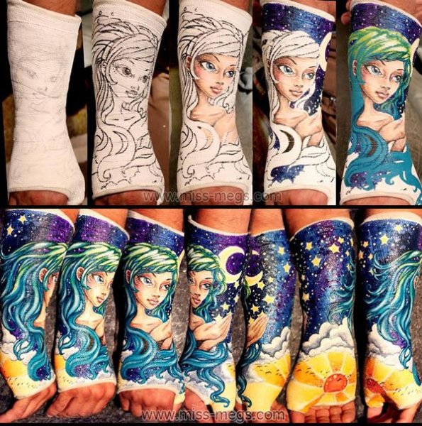 Разрисованный гипс на ноге