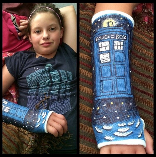 Разрисованный гипс