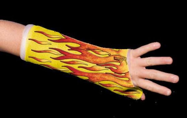 Разрисованный гипс на ноге