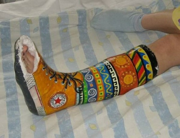 Изрисованный гипс на ноге