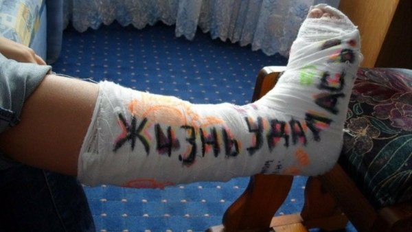 Разрисованный гипс на ноге