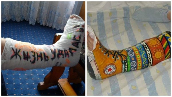 Рисунки на гипсе на ноге