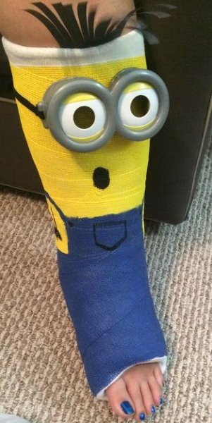 Раскрашенный гипс на руке