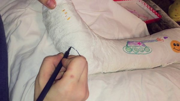 Прикольные надписи на гипсе на ноге