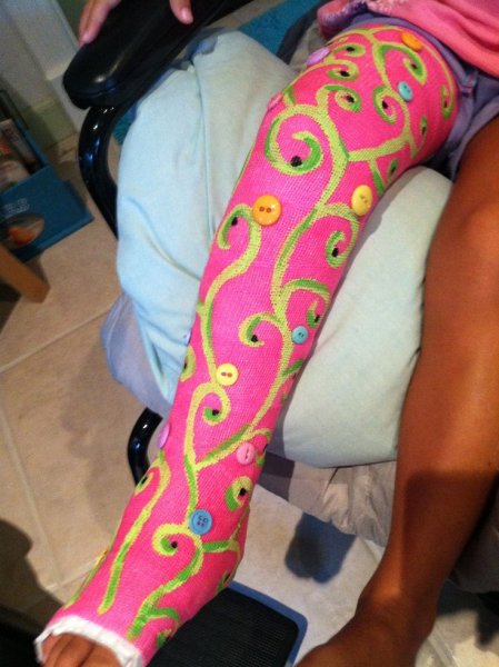 Сломанная рука рисунок