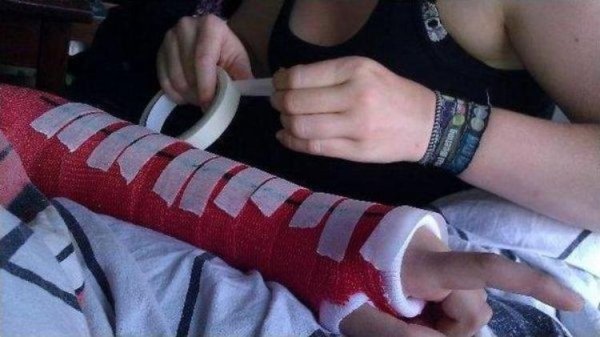 Роспись гипса на руке