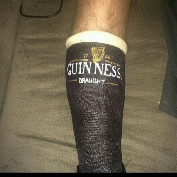 Разрисованный гипс