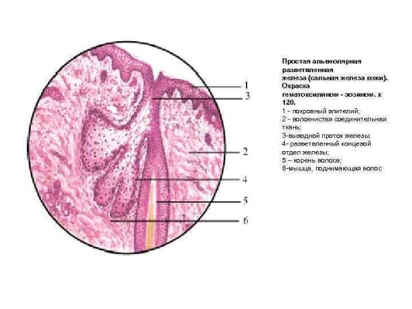 Простая альвеолярная разветвленная сальная железа кожа