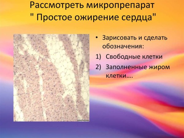 Простое ожирение миокарда микропрепарат