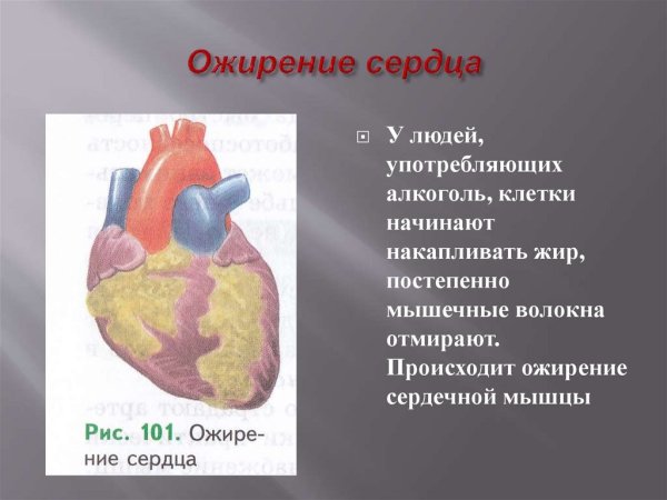 Ожирение сердца причины