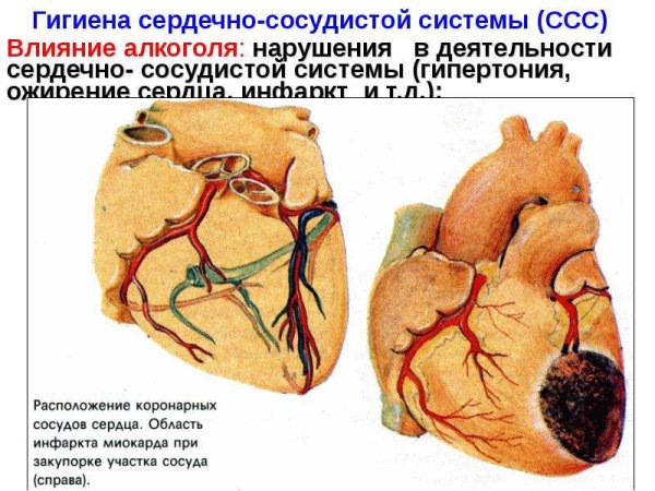 Жировое Перерождение сердца