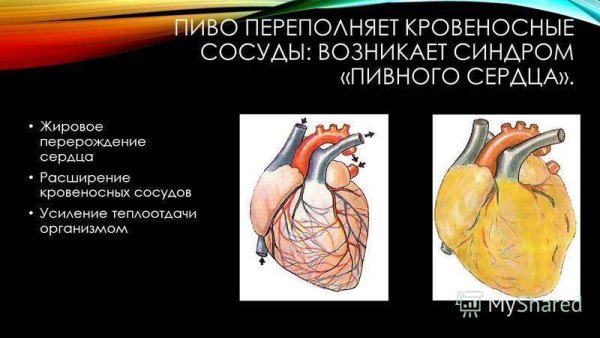 Первичный билиарный цирроз печени патанатомия