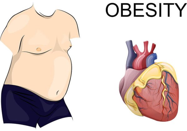 Сердце человека страдающего ожирением