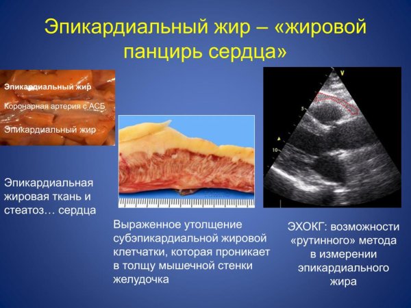 Человеческое сердце в жире