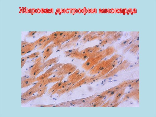 Толстый мультяшный