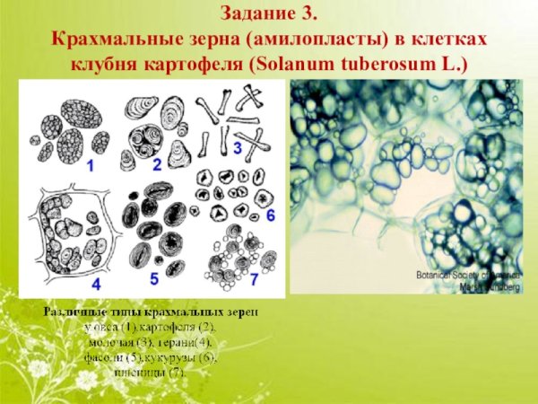 Кристаллы оксалата кальция