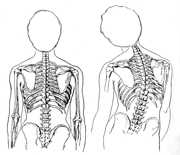 Силуэт позвоночника человека