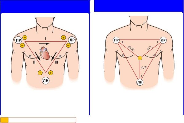 ЭКГ стандартные отведения наложение электродов
