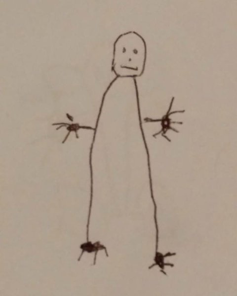 Человек с маленькими ручками