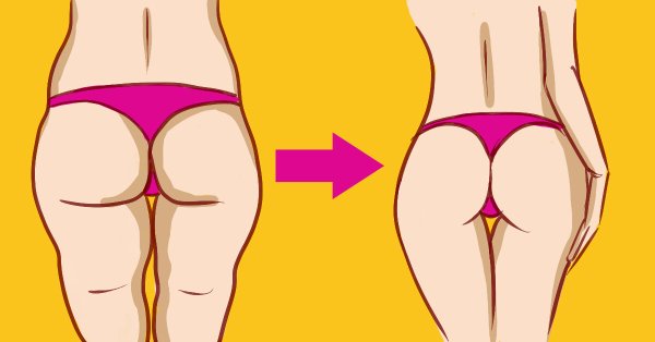 Формы ягодиц