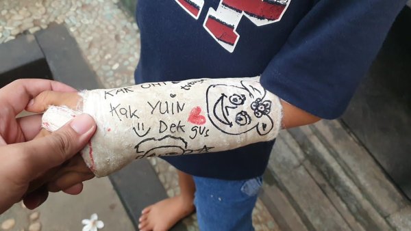 Разукрашенный гипс