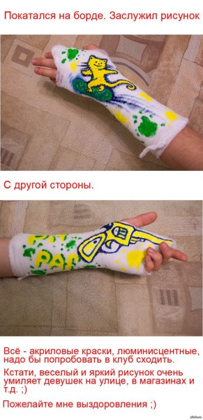 Раскрашенный гипс на руке