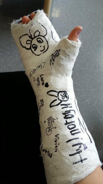 Разрисованный гипс