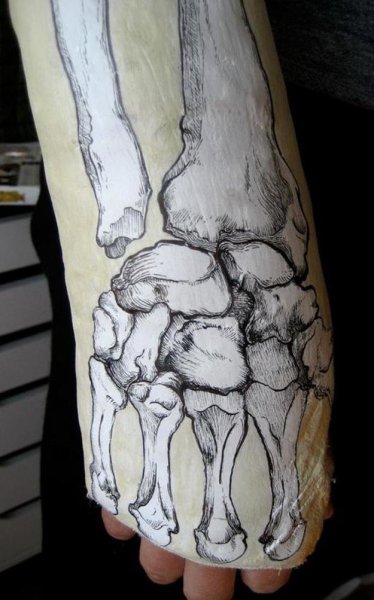 Гипс на ноге иллюстрация