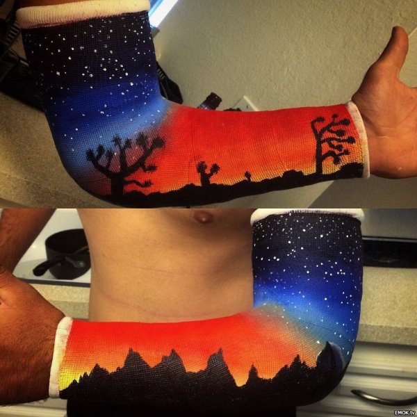 Перчатка ТАНОСА на гипсе