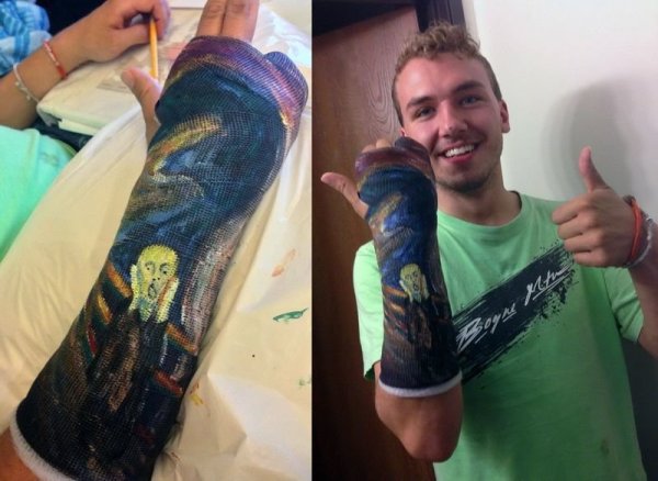 Раскрашенный гипс на руке