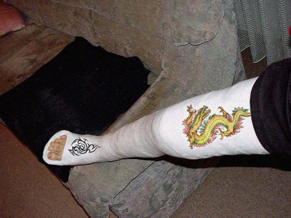 Креативные рисунки на гипсе на ноге