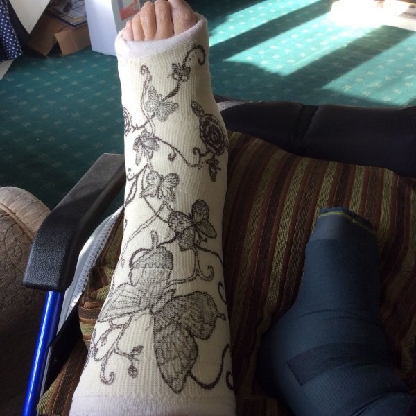 Разрисованный гипс