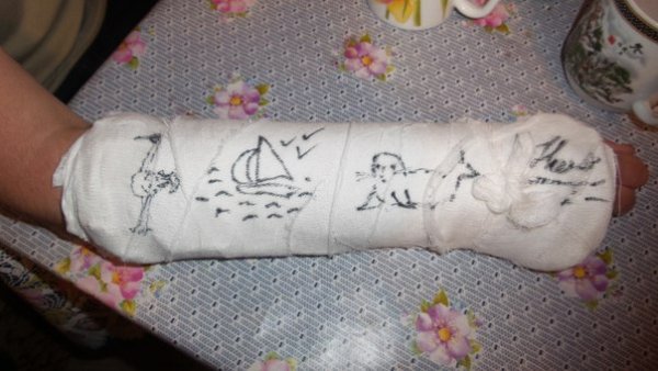 Разукрашенный гипс